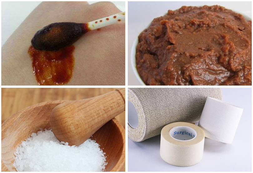 烫伤擦酱油了怎么办,被烫伤之后的红印可以涂牙膏吗