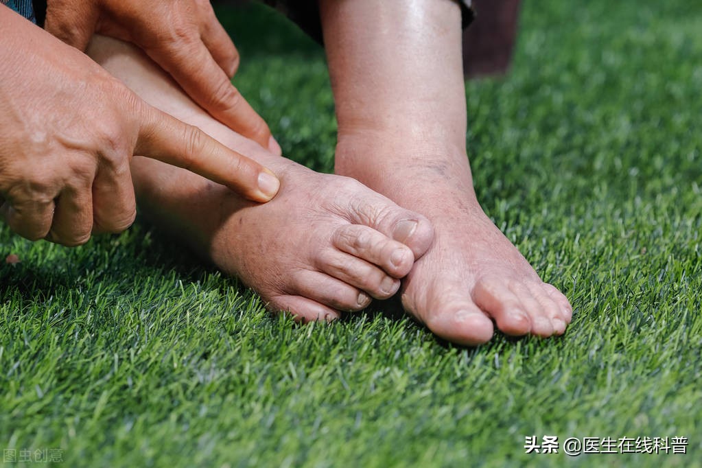 高血压肾病会要命？老中医亲证心态乐观+规范治疗，可正常生活