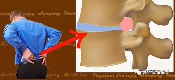 72岁老人腰疼还有骨刺该怎么治疗,老年人骨刺疼痛怎么治疗