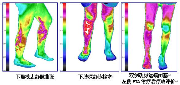 70岁老人不活动就感觉呼吸费劲,老人不咳但呼吸困难是什么原因
