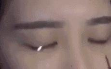 割双眼皮对面相有改变吗,割双眼皮对面相好吗