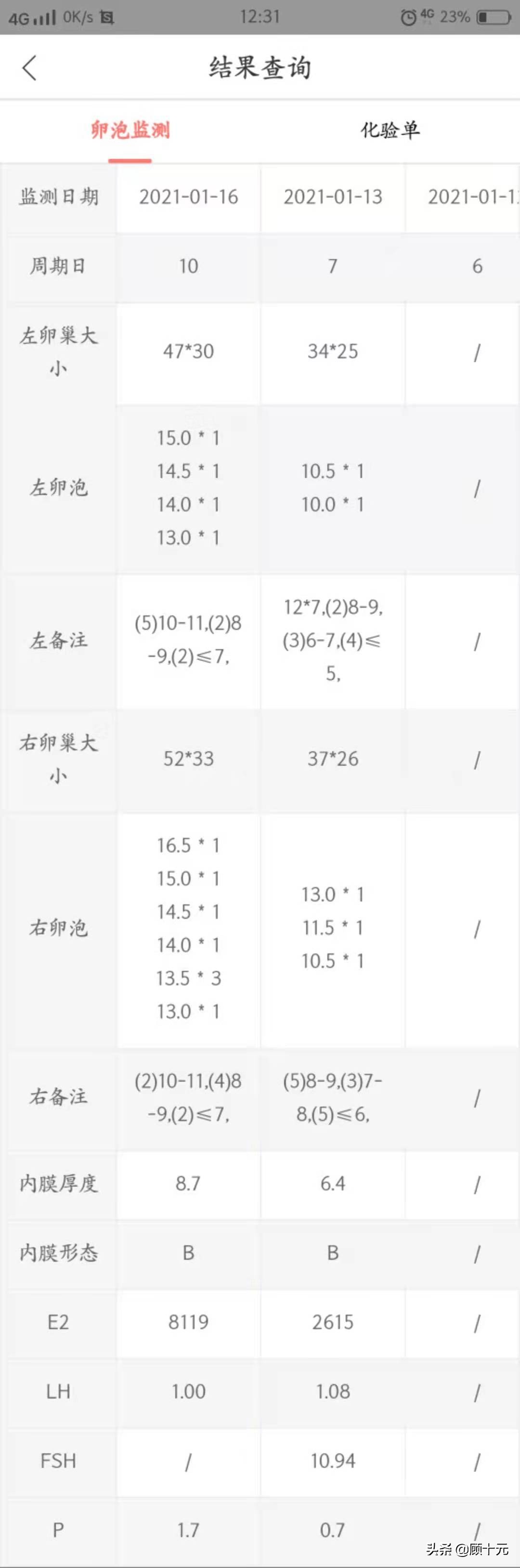 试管婴儿促排卵针视频,试管婴儿打针成功案例