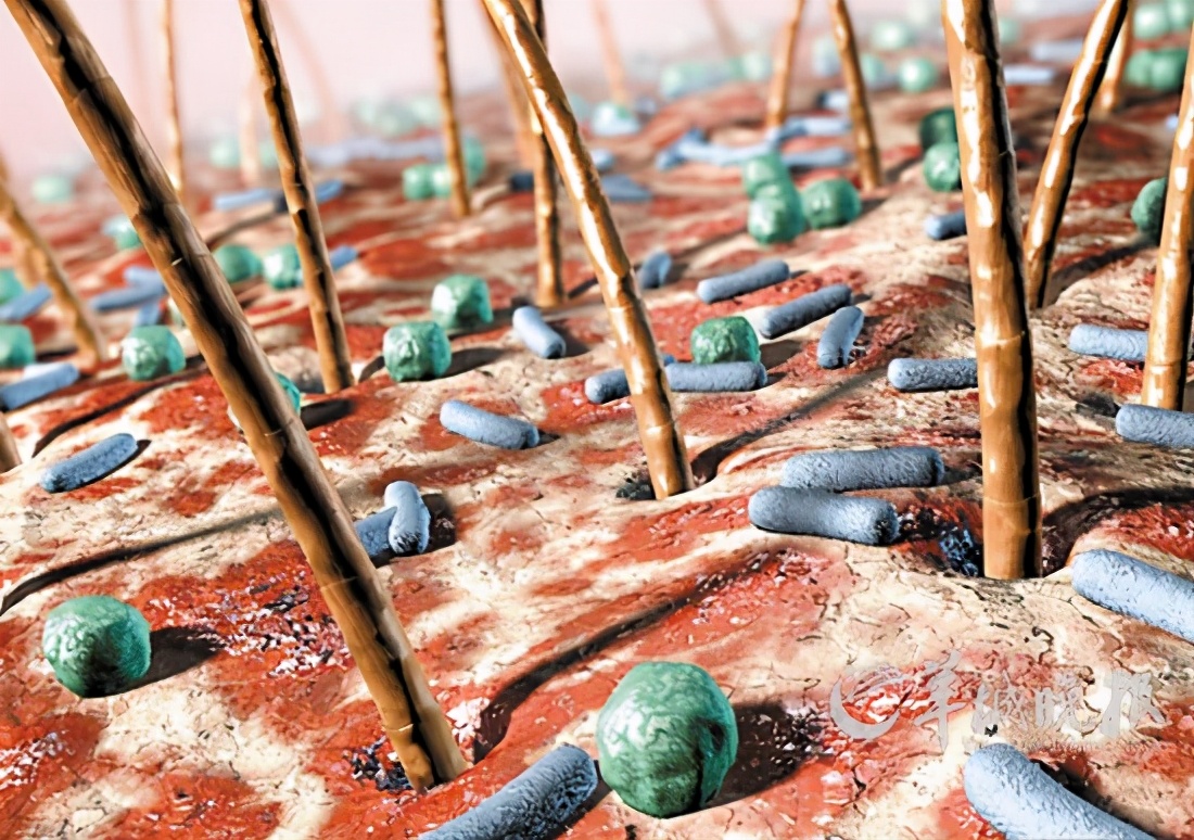 皮肤微生物检测,如何做好皮肤的微生物管理