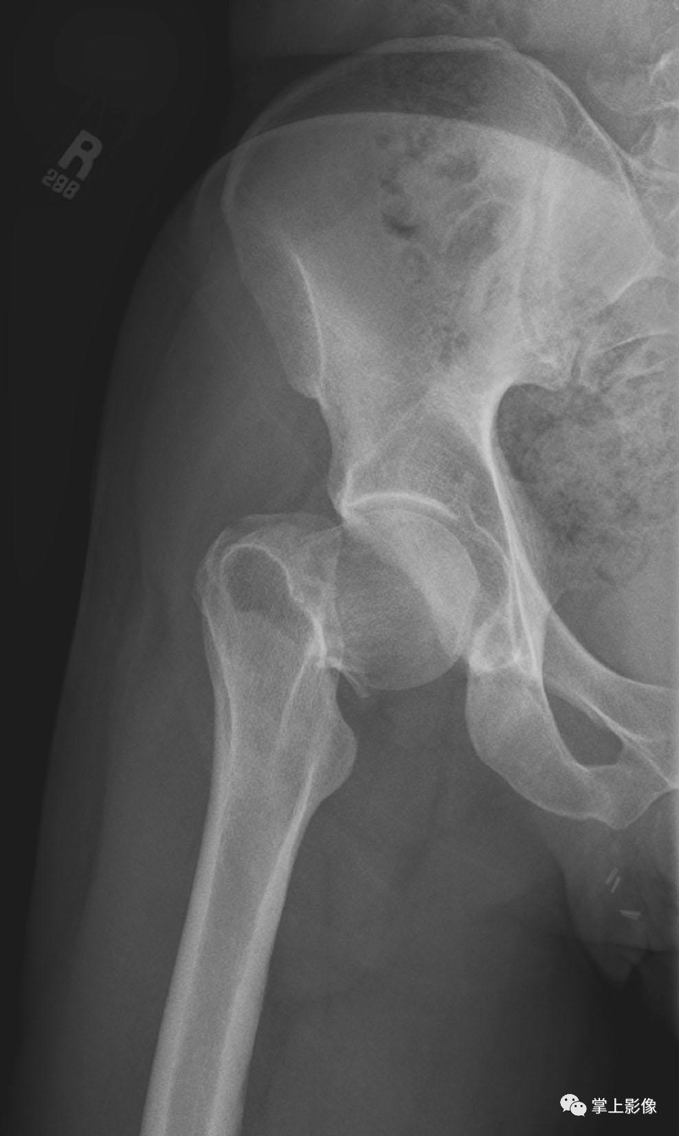 一种很少人知道的疾病,有哪些关节疾病