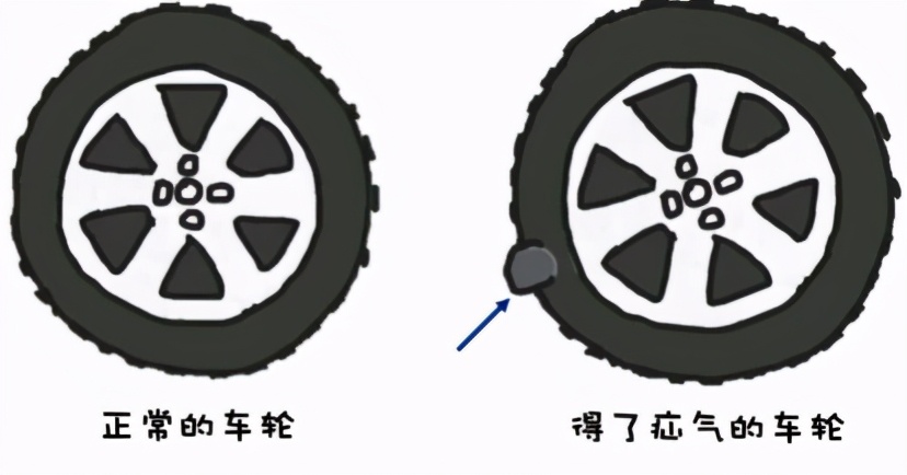 婴儿疝气开刀手术,疝气开刀要多少钱