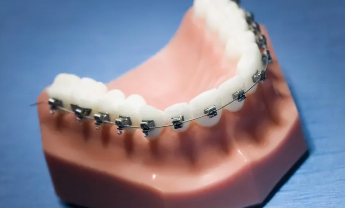 牙科诊所暴利视频,牙科暴利是真的