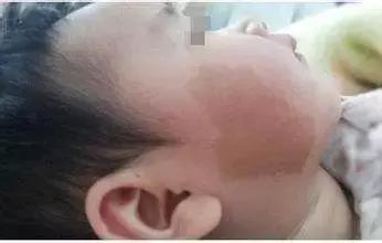 宝宝屁股上的青色印记是怎么回事,宝宝屁股上有青斑是怎么回事