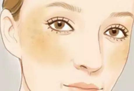 县医院美容科能祛斑吗,医院美容科祛斑全过程