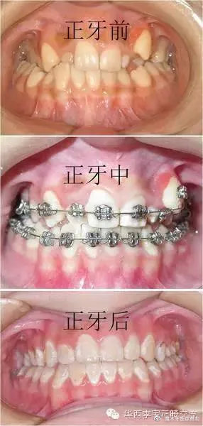 铜川乡*党**，矫牙前，请一字不漏读完这篇！