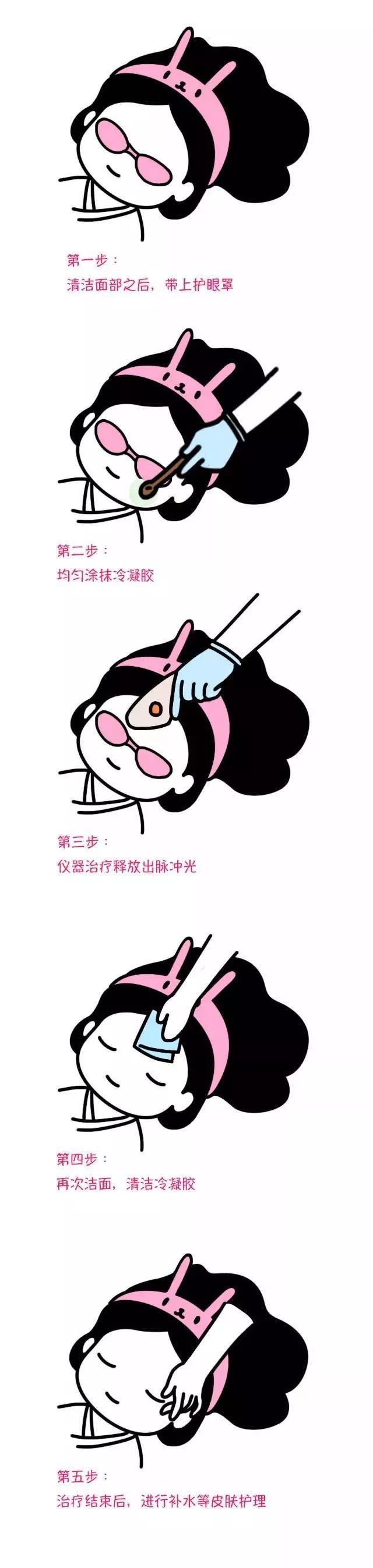 queen93光子治疗仪使用方法,美容皇后仪器