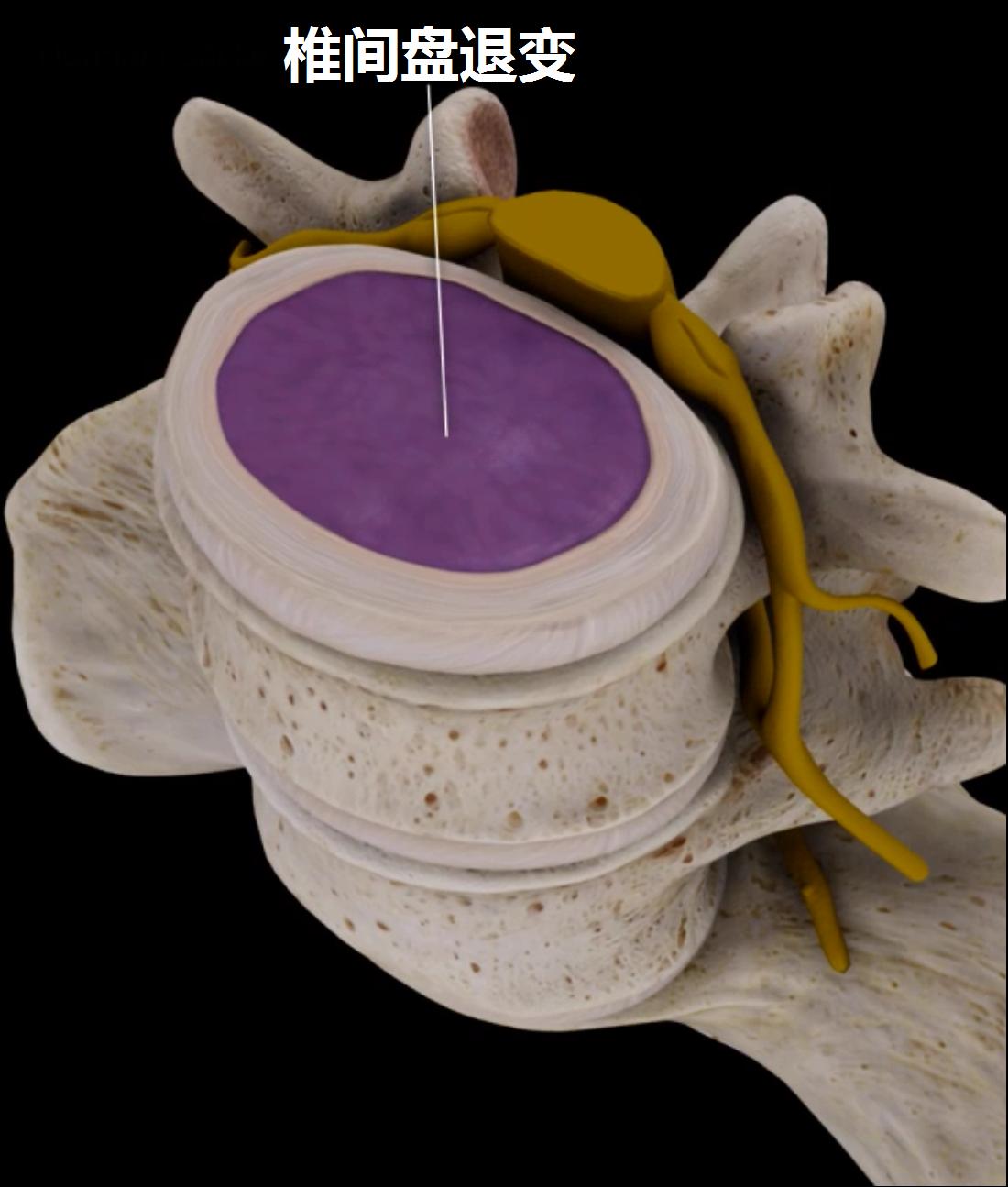 预防腰痛的正确方法,关于腰痛治疗方法有哪些