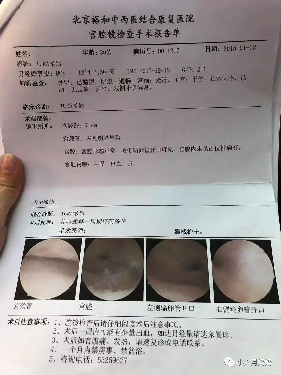 宫腔粘连不治疗会有什么后果,宫腔粘连可以吃中药调理好吗