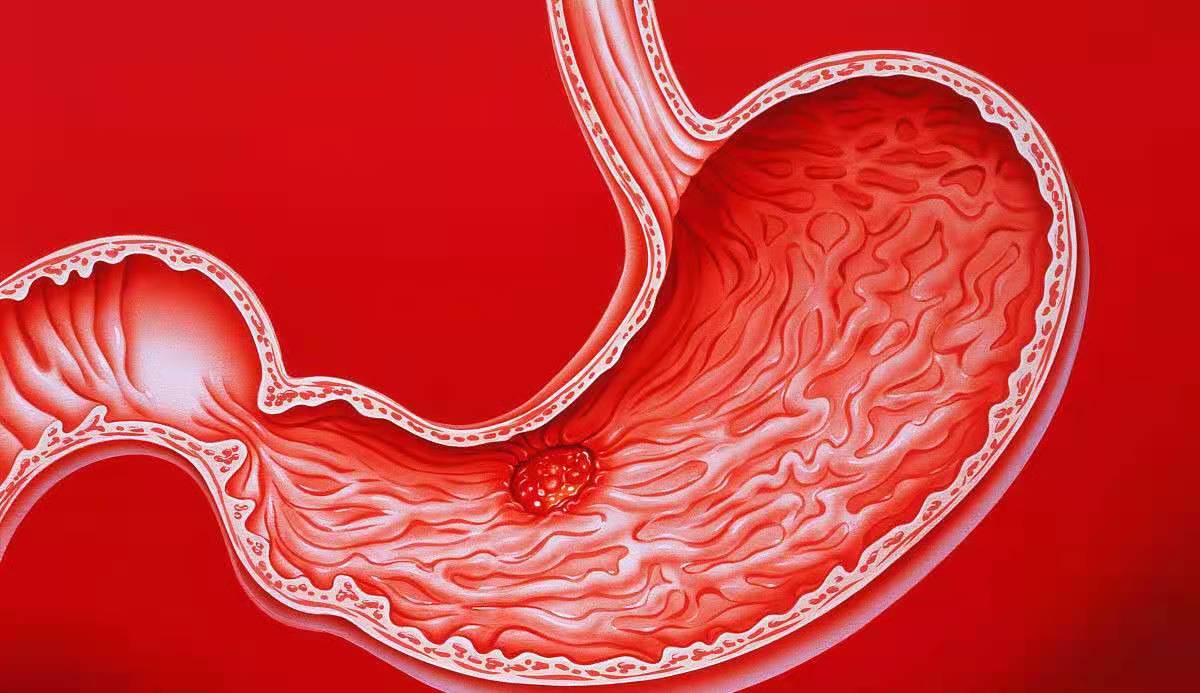 胃酸过多吃奥美拉唑可以缓解吗,胃酸烧心吃奥美拉唑多长时间
