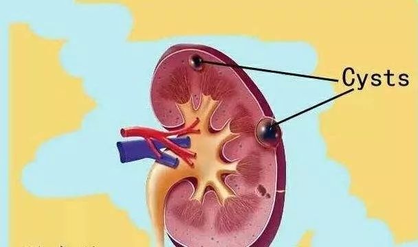 身体有结节囊肿息肉怎么调理,为什么总是长囊肿息肉结节等疾病