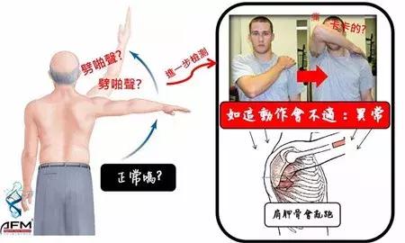 肩颈理疗瑜伽一招解决肩膀疼痛,肩膀咔咔卡住一招恢复好