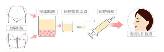 法令纹都是有什么方法可以去除,去法令纹最有效的办法明星