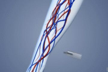 手术的时候医生对你做了什么,手术时切了一片肺叶