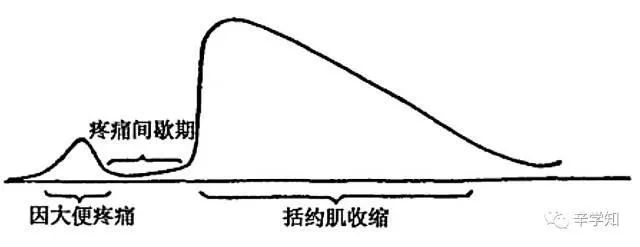 肛裂混合痔手术后又肛裂,肛裂为什么要手术