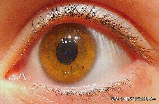 眼球人体解剖学讲解,眼睛解剖讲解
