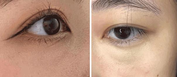 无效遮瑕测评,无效遮脸