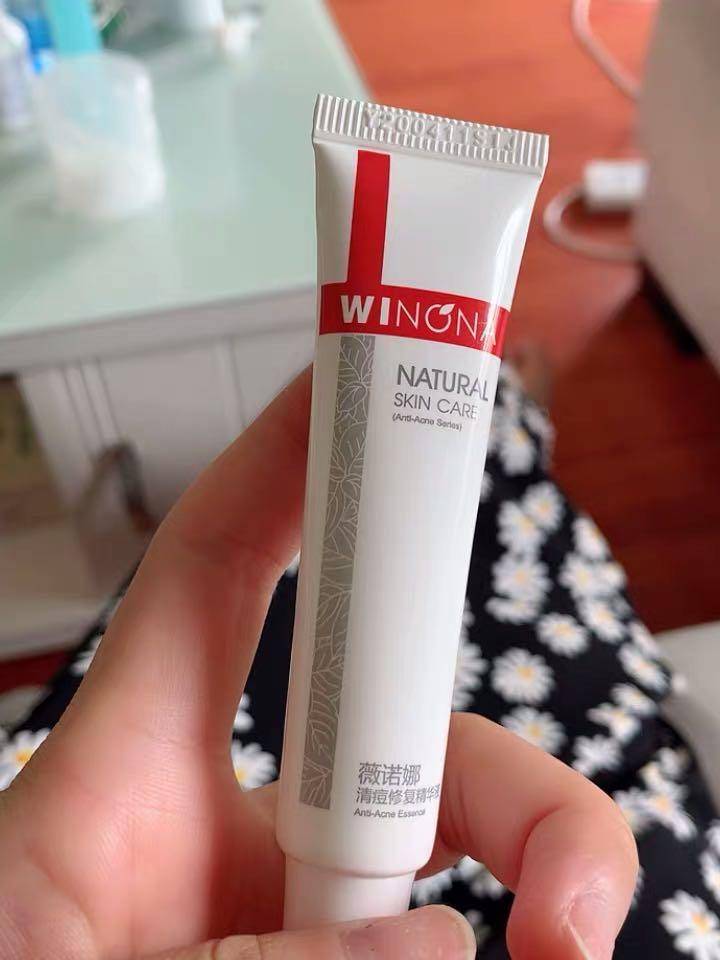 油痘肌如何祛痘控油,祛痘控油护肤品好物推荐