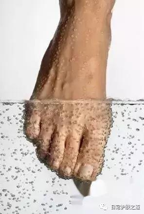 脚底死皮很厚又硬,脚底死皮又厚又硬怎么去除