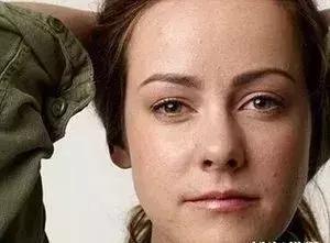 夏天脸上干燥起皮怎么办,夏天脸上干燥起皮用什么护肤品