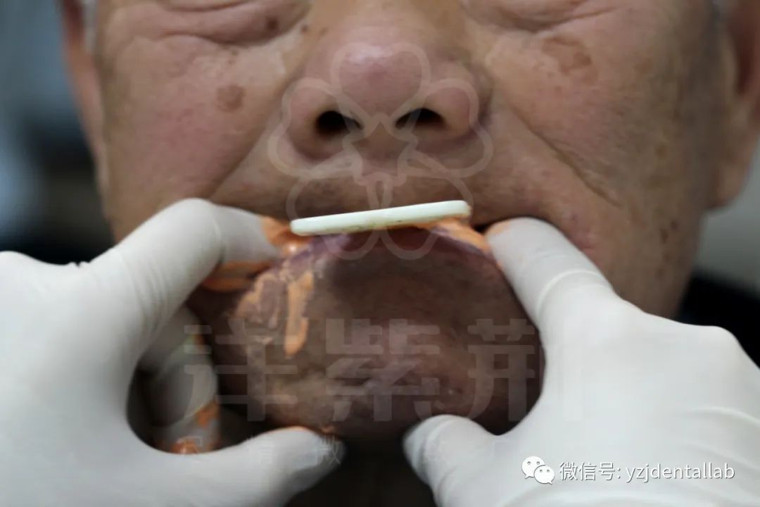 病例教学视频,病例分析操作技能