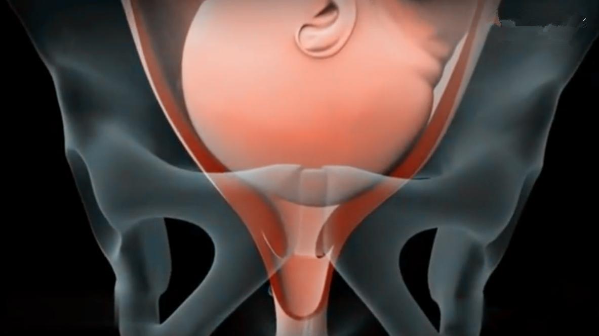 产妇还没进产房就生了,顺产不想侧切要跟医生怎么说