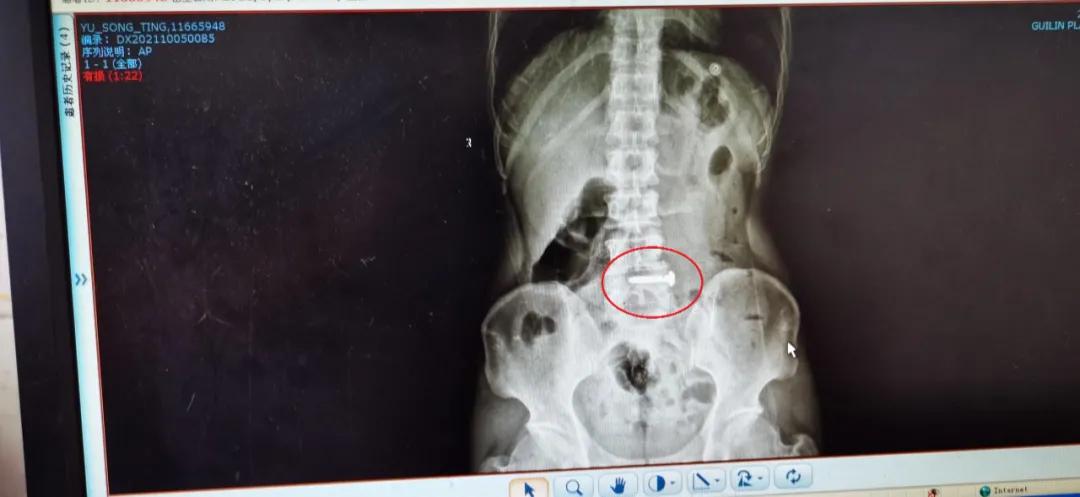 秀峰警察抓捕现场视频,秀峰杀人事件