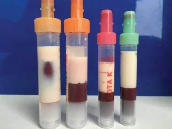 男子生殖器自燃的新闻,男性生殖器着火