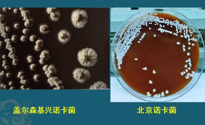 肺诺卡菌感染,当1种分解落叶的细菌,被吸入肺脏