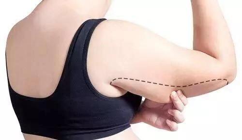 女生手臂越来越粗的原因,女生手臂越练越粗