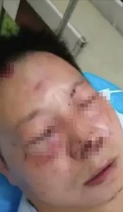 男子当街暴打的哥被刑拘,当街殴打踹飞男子被刑拘