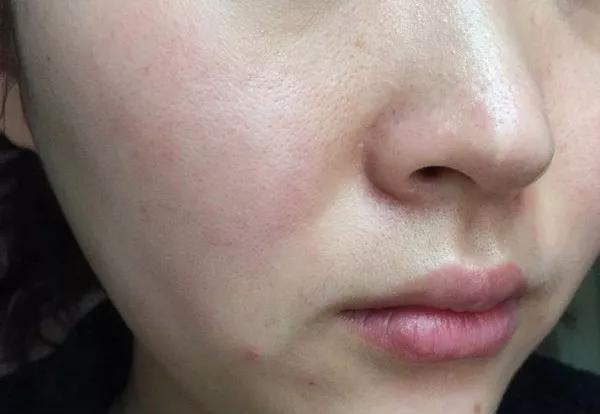 火山泥真是宝，油皮女孩的毛孔疏通剂，让贵妇霜3秒吃透锁水8倍