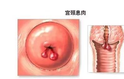 孕早期出血常见,孕早期出血常见吗