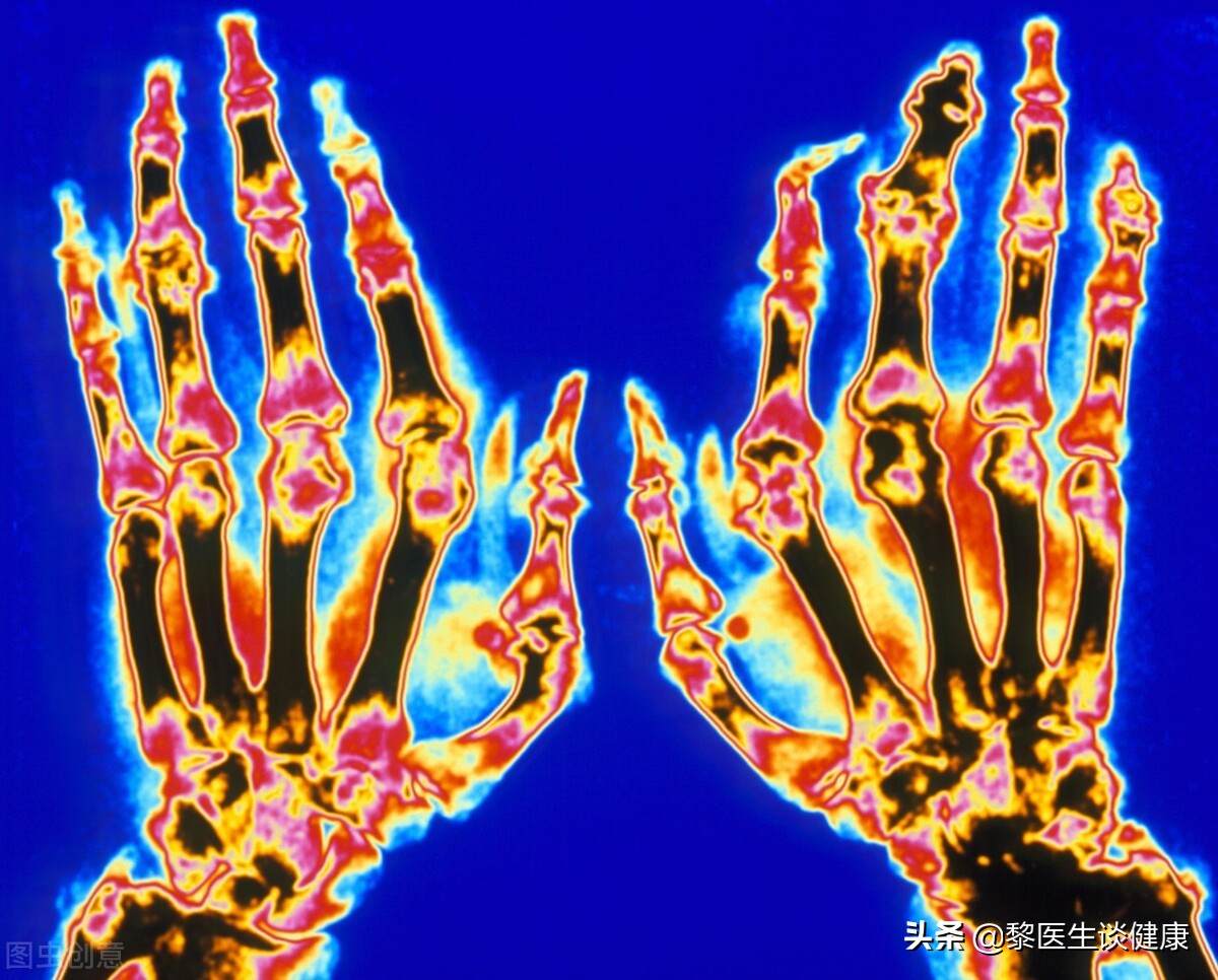 痛风反复发作吃什么药治疗最有效,痛风反复如何治疗