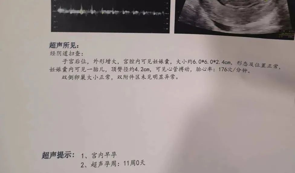 孕期复查胎儿侧脑室宽做什么b超,孕期一般做几个b超