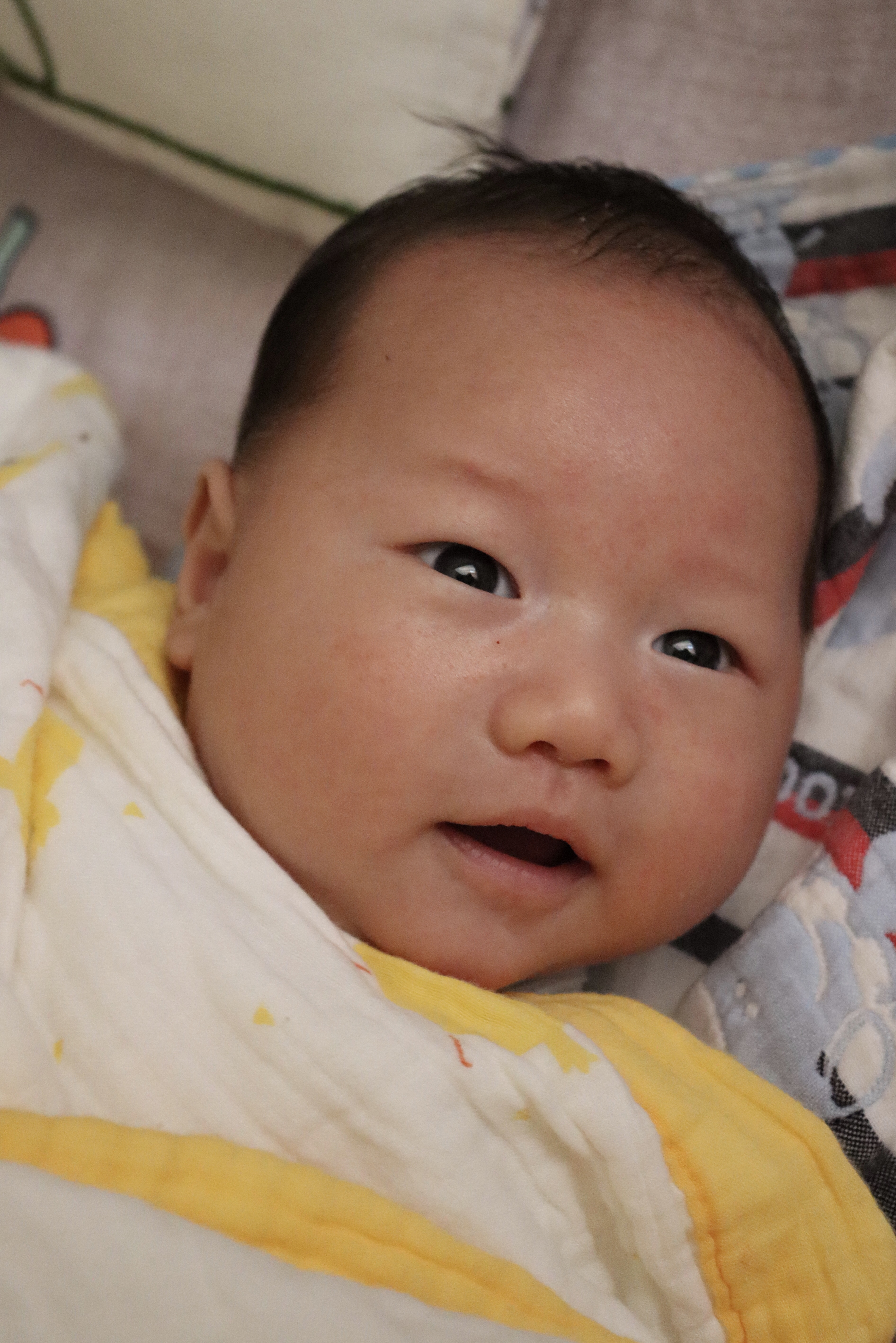 新生儿宝宝全身出红疹,新生儿满脸疹子