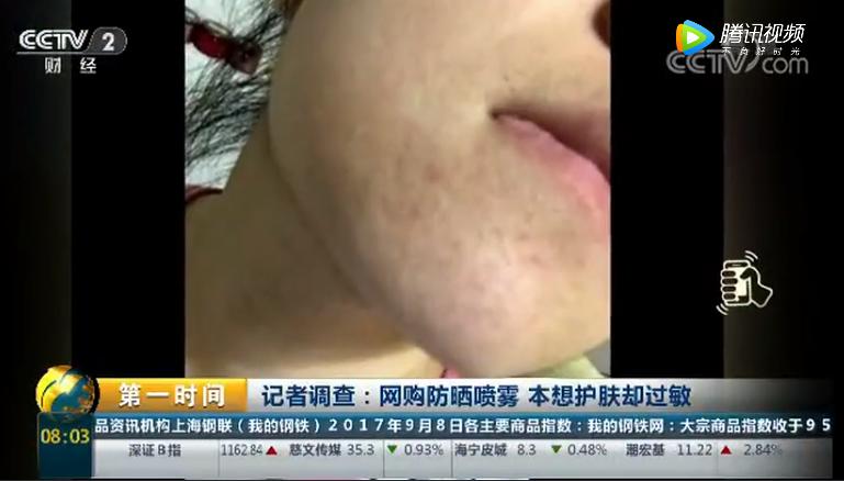 晒伤皮肤修护推荐,适合晒伤修复的护肤品