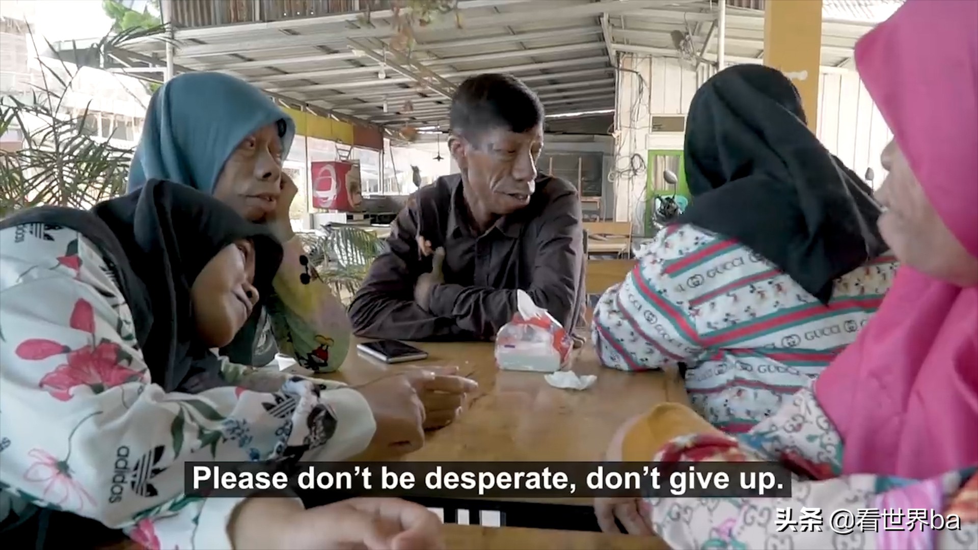 印尼家族怪脸,印尼怪病