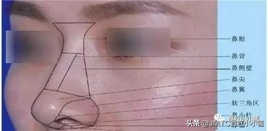 鼻子怎么修复好看呢,鼻型修复方法大全