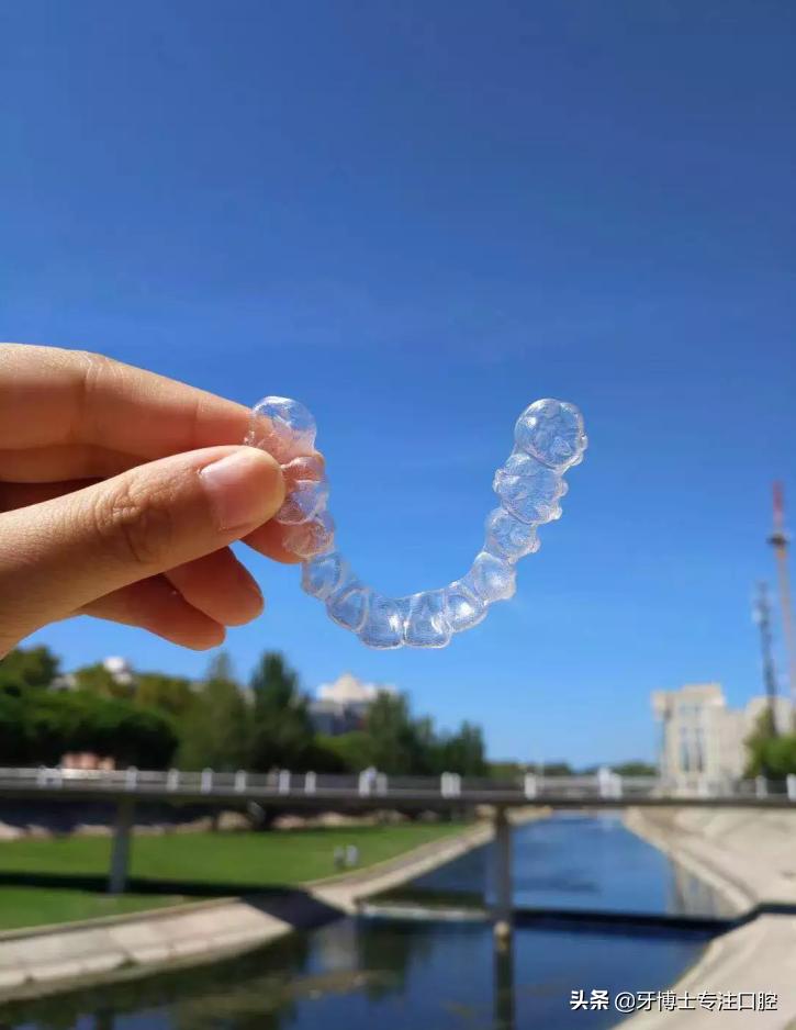 明星牙齿矫正前后对比,明星牙齿矫正都用的什么矫正方式