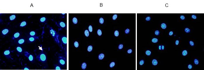 支原体污染细胞,细胞培养中的污染预防措施