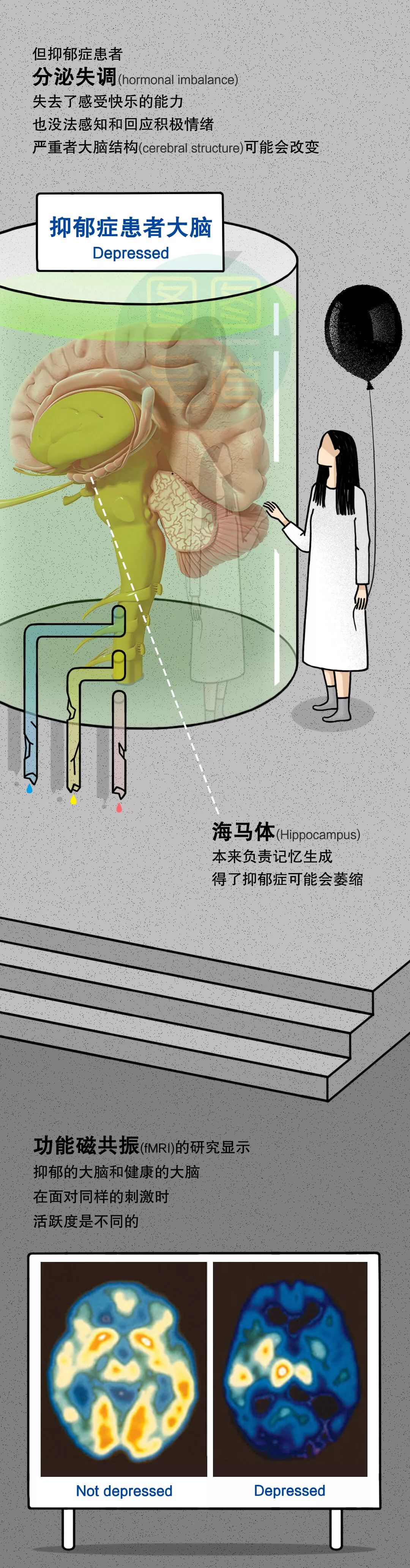 最近抑郁症频繁发作受不了,最近有抑郁症怎么办