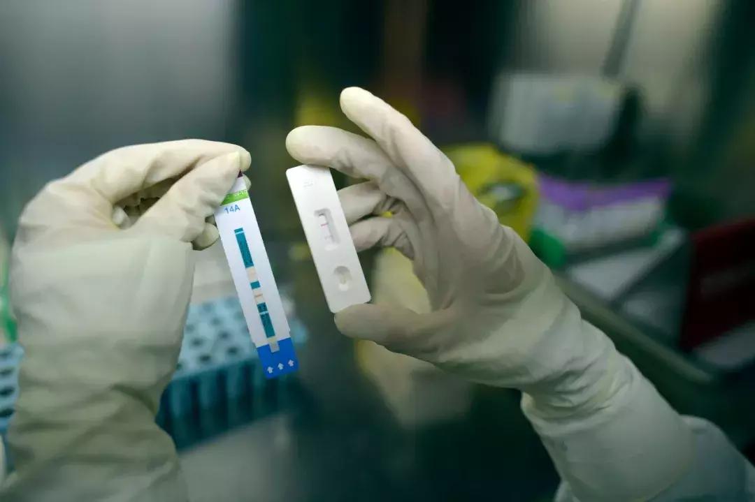 艾滋病自测试纸无人售卖,艾滋试纸多少钱