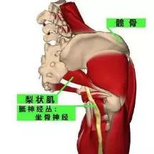 钱包越厚，屁股越痛？真的！它还有个医学名字