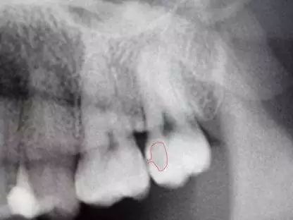 小孩拍牙齿片有危害吗,拍牙片对孩子的影响