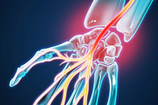 手指肿胀要警惕三种病,手指肿胀是10种疾病的警示信号