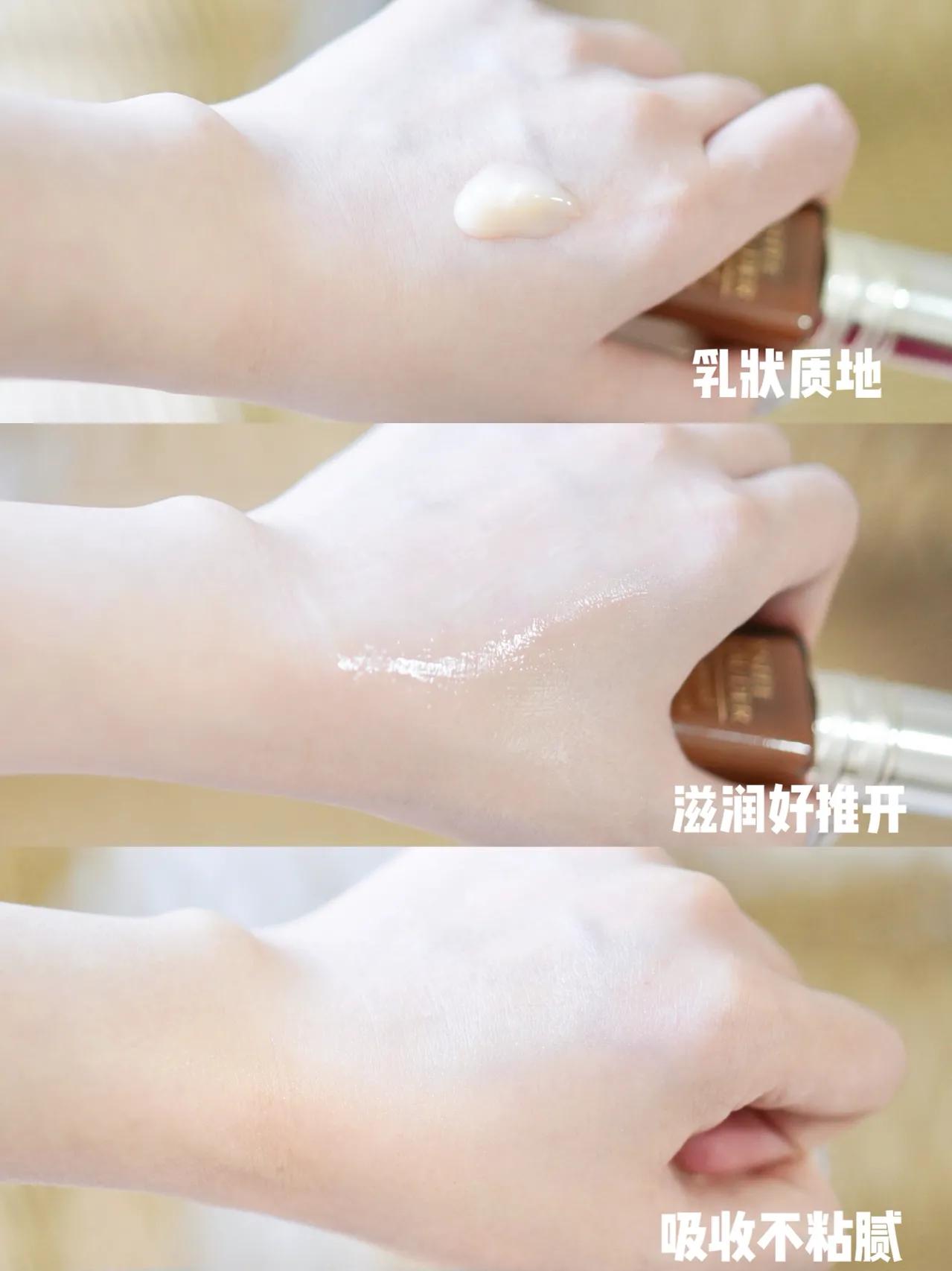 战痘第一步先要认清痘痘类型,科普长痘原因和建议